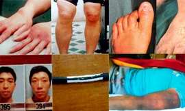 Những vụ dùng 'nhục hình' dã man như thời trung cổ