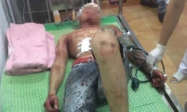Nạn nhân bị côn đồ chém vỡ hộp sọ
