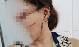 Rạch mặt, cắt gân chân vợ sau chuyến xuất khẩu lao động