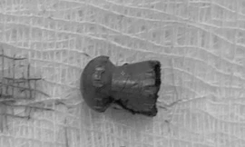 Đang làm lúa ngoài đồng, nam thanh niên bất ngờ bị đạn lạc xuyên 'của quý'