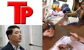 Bản tin Hình sự: Tin mới vụ Việt kiều bị tạt axit, bỏng 80% cơ thể