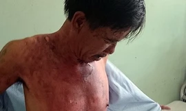 Nạn nhân Nguyễn Văn Lộc tại bệnh viện