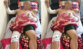 Anh Yên bị chém gục tại quán ăn đang được điều trị tại bệnh viện