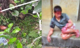 Hiện trường vụ việc và nạn nhân