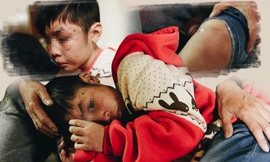 Bé trai tại thời điểm bị bố đẻ và mẹ kế bạo hành dã man