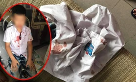 Em N.G.K. sau khi bị Đức hành hung. Ảnh: Hóng biến Hòa Bình