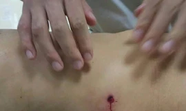 Viên đạn xuyên thủng vùng bụng của nạn nhân