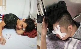 rung úy Giang điều trị tại Bệnh viện đa khoa Hà Tĩnh (ảnh trái) và nạn nhân Hoài được chuyển ra Bệnh viện Việt Đức phẫu thuật (ảnh phải)