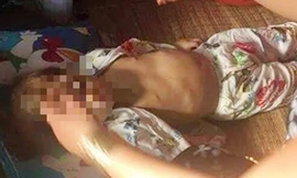 Bé gái 4 tuổi chết bất thường, nghi bị bạo hành