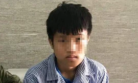 Nam sinh H.C.Kh. được chẩn đoán bị gãy xương hàm dưới bên trái