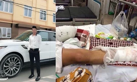 Nhóm côn đồ bịt mặt đi ô tô chém nát chân 9X