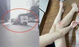 Cô gái Hà Nội kể phút bị xe tải đe dọa 'mày tin tao đâm không' rồi húc ngã