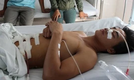 Tô Trung sau khi phẫu thuật, đang được theo dõi điều trị tại bệnh viện tỉnh Ninh Thuận. Ảnh: Báo Pháp luật TPHCM