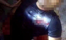 Lái xe Tuân và vết đạn xuyên ngực trái dẫn đến tử vong