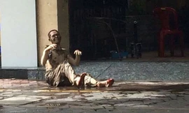 Bác sĩ tiên lượng xấu về tình trạng sức khỏe của nạn nhân Sơn. Ảnh: Zing