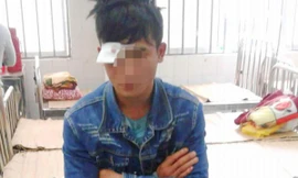 Anh T. với vết thương trên mắt 