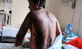 Ông Hà hứng trọn ca axit của hai kẻ lạ mặt