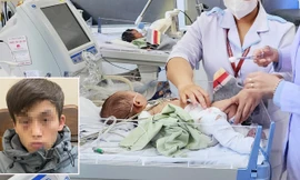 Bé 2 tháng tuổi bị người tình của mẹ bạo hành dã man: Gãy xương đùi khoảng 1 tháng trước