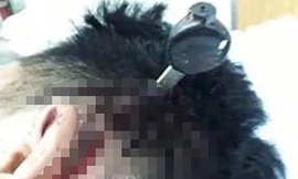 Hỗn chiến do mâu thuẫn trên facebook, 2 học sinh lớp 10 trọng thương