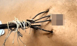 Con trai dùng chĩa đâm cha tử vong