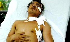 MC truyền hình bị cướp đâm trọng thương vào nửa đêm