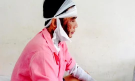 Anh Minh bị tạt axit khi vừa ra khỏi công ty