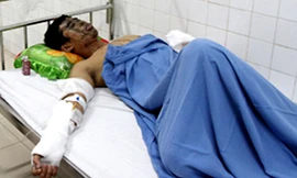 Thái nói rằng không mâu thuẫn với ai để bị tạt axit. Ảnh: Nguyễn Đông