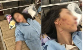 Cô gái bị 'lột đồ, đổ nước mắm' giữa phố lên tiếng