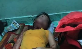 Nạn nhân bị chém với vết thương trên má