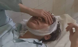 1 trong 6 thanh niên bị chém khi uống cà phê