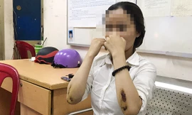 Cô gái kể lại giây phút bị cướp kéo lê trên đường