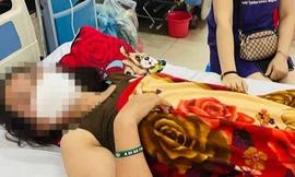 Hy hữu: Người phụ nữ bị thang máy rơi trúng đầu