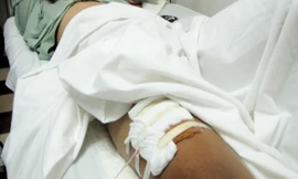 Công an xã bắn gãy chân kẻ quậy phá