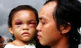 Xác định cha ruột bé 4 tuổi bị bạo hành