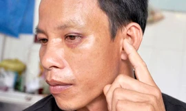 Anh Hồng bị thủng nhĩ tai trái, bầm mắt