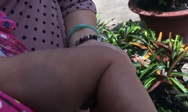 Vết bầm ở chân cháu bé nghi bị bà Loan đánh.