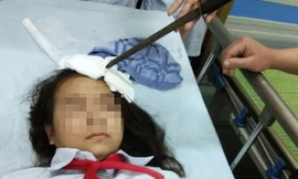 Cháu N.T.H lúc mới nhập viện trong tình trạng dao cắm vào trán. Ảnh: báo Hà Nam