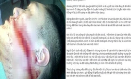 Hình ảnh nam sinh bị rạch mặt đưa chia sẻ trên Facebook cá nhân