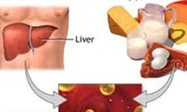Làm gì để phòng ngừa tăng cholesterol máu?
