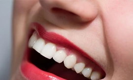 Bí mật giúp bạn có hàm răng trắng bóng hơn