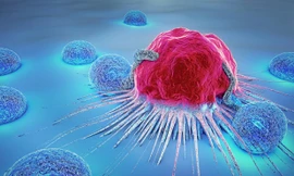 Các nhà khoa học Anh đã nghiên cứu phát triển virus enadenotucirev có thể tiêu diệt tế bào ung thư mà không làm hại tế bào khỏe mạnh. Ảnh minh họa.