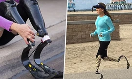 Nghiên cứu mới của các nhà khoa học Nga sẽ giúp những người bị mất chân, tay có thể trở thành người lành lặn.