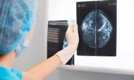 Do các bác sĩ không bao giờ loại bỏ các tế bào ung thư trong các cơ quan quan trọng được hiến tặng, chúng đã biến thành kẻ thù nội gián trong cơ thể người được cấy ghép.