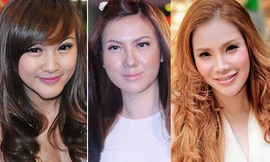 Những sao Việt ‘khốn đốn’ vì phẫu thuật thẩm mỹ