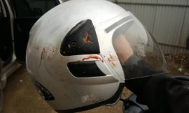 Mũ bảo hiểm của nhà báo Đỗ Doãn Hoàng dính máu khi bị hành hung