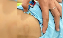 Bình Thuận: Đình chỉ hoạt động cơ sở giữ trẻ vượt quá số lượng quy định