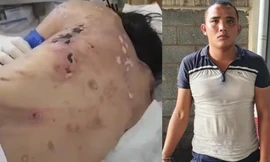 Nạn nhân với nhiều thương tật trên cơ thể và kẻ chủ mưu Lê Thế Diện