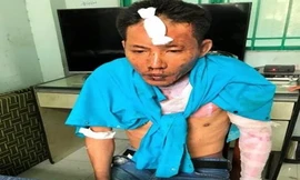 Nghi can Nguyễn Quang Dũng cũng bị bỏng nhẹ sau vụ việc