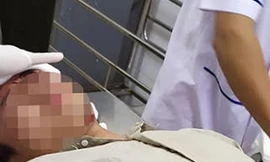 Điều tra nhóm người xông vào trạm kiểm lâm hành hung nhân viên, cướp đi xe máy   