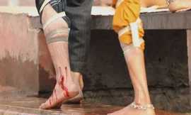 Chữa bệnh bằng trích máu ở Ấn Độ